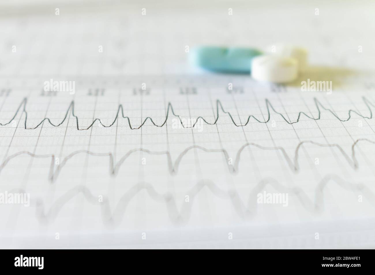 Pilules blanches, bleues et bleu clair sur un papier d'électrocardiogramme. Médicaments pour les patients cardiaques. Battements de cœur enregistrés sur papier. Banque D'Images