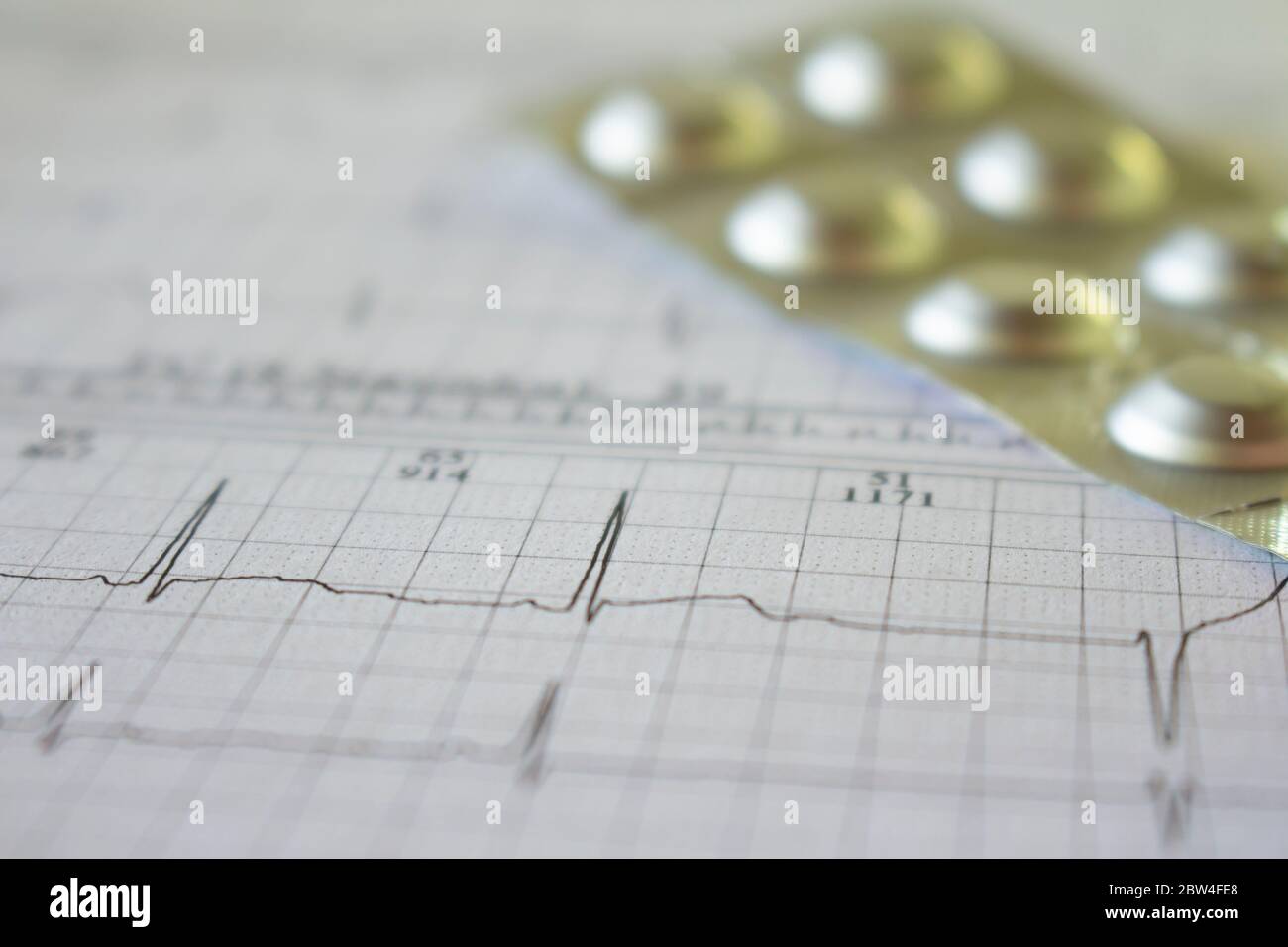 Plaquette métallique sur papier pour électrocardiogramme. Médicaments pour les patients cardiaques. Battements de cœur enregistrés sur papier. Banque D'Images