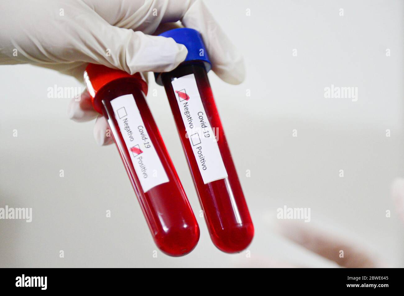 Florianópolis - SC, 29/05/2020 - testicules de sangue do COVID-19.. Foto: Eduardo Valente/iShoot (Foto: Eduardo Valente/iShoot/Alay (Télécharger com legenda e Banque D'Images