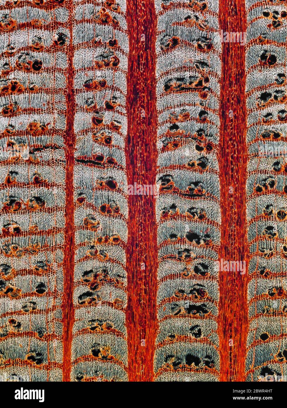 Cellules en bois d'arbre, structure générale, LS. Banque D'Images