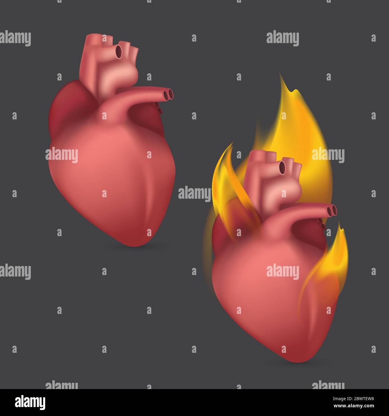 Cœur anatomique brûlant. Organe humain réaliste du système de circulation sanguine interne en flamme. Illustration vectorielle Illustration de Vecteur