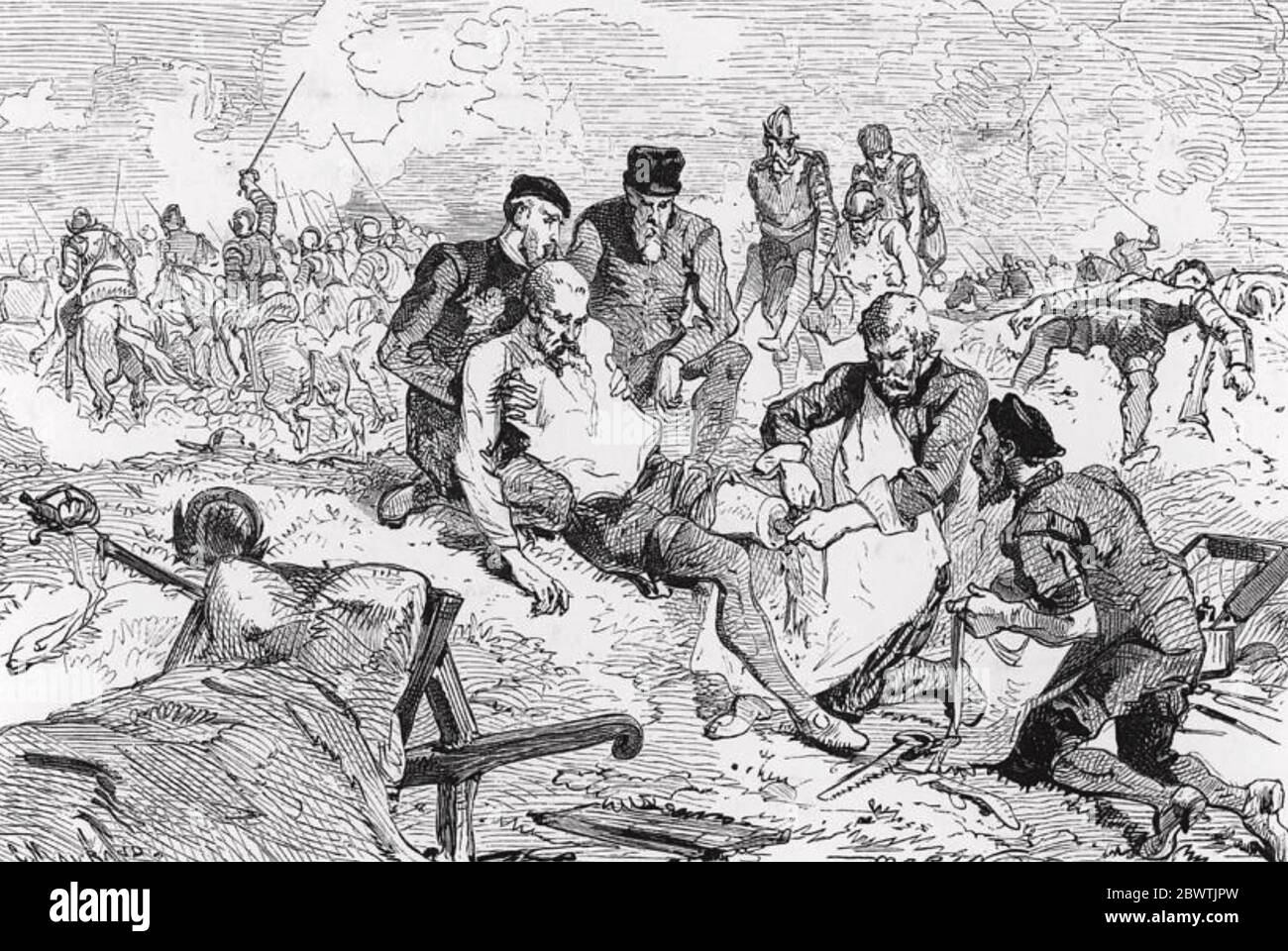 AMBROISE PARÉ (c 1510-1590) chirurgien français qui a été le pionnier de l'utilisation de la ligature comme le montre cette gravure du XIXe siècle Banque D'Images