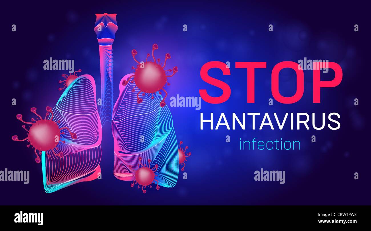 Arrêter l'illustration du vecteur d'infection à Hantavirus avec les poumons humains, les cellules bactériennes et les microbes. Modèle de bannière de soins de santé pour le syndrome pulmonaire (SPH) pour ou Illustration de Vecteur