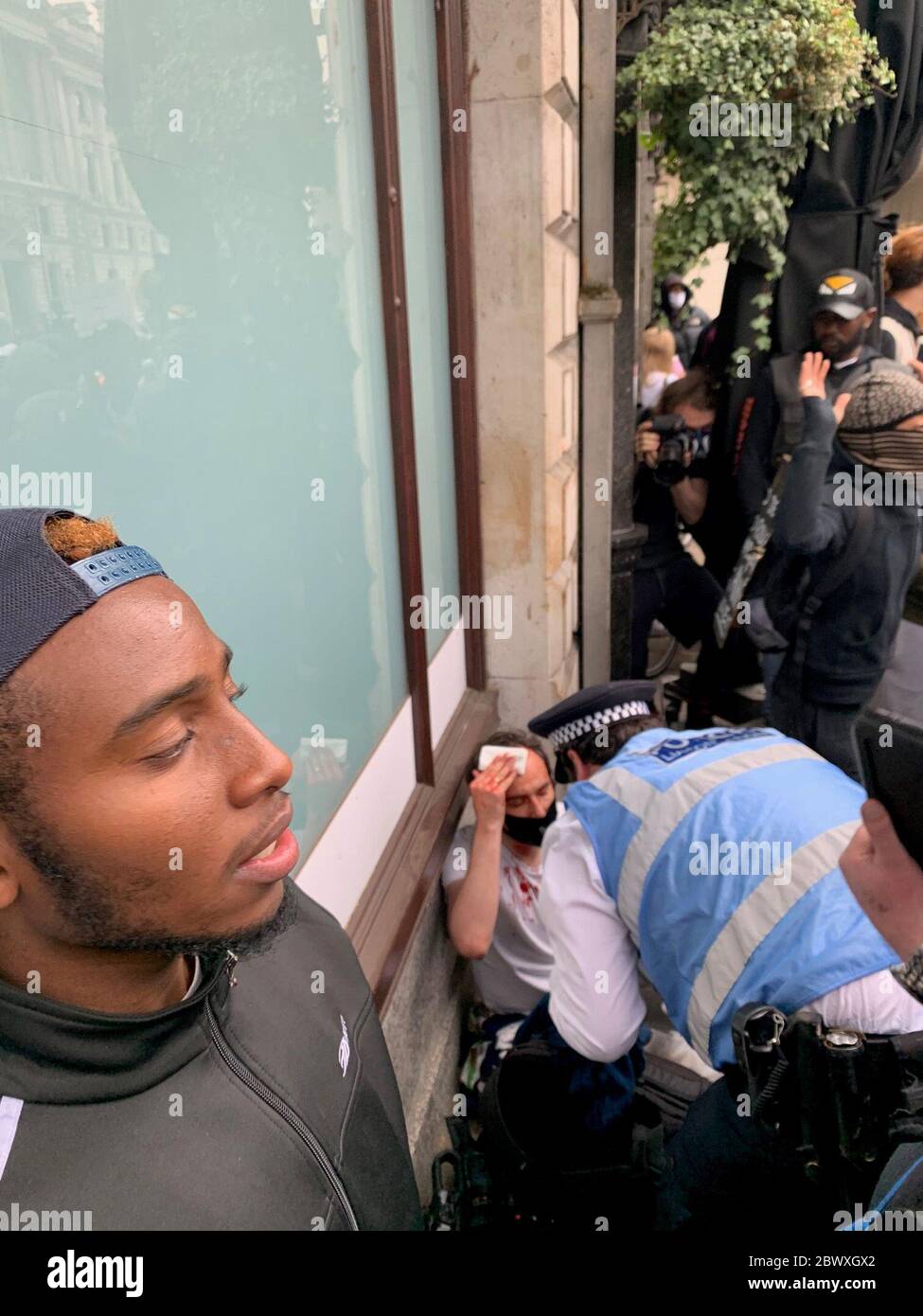 NOTEZ LE CONTENU GRAPHIQUE D'UN homme qui a subi une blessure lors d'un rassemblement de protestation Black Lives Matter près de Hyde Park, Londres, qui se déroule à la mémoire de George Floyd, tué le 25 mai alors qu'il était en garde à vue dans la ville américaine de Minneapolis. Banque D'Images