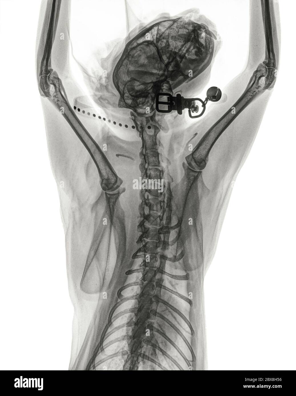 Radiographie numérique dorso-ventrale du thorax, des jambes avant et de la tête d'un chat normal avec collier et cloche de chat. Isolé sur blanc Banque D'Images