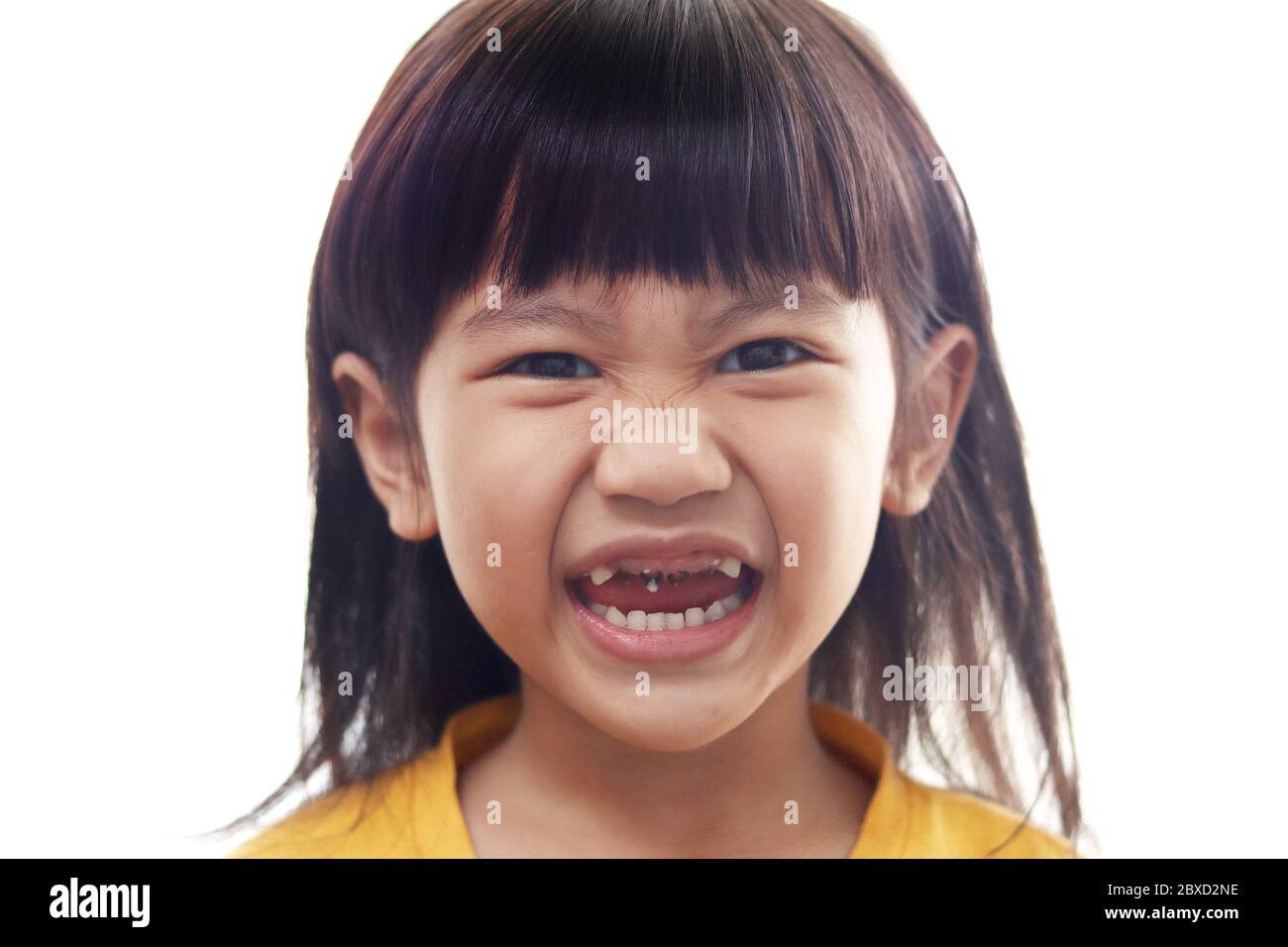 Petite fille asiatique montrant sa bouche ouverte pleine de caries dents de carie carie carie. Médecine dentaire et soins de santé. Caries à partir d'un âge précoce en raison de trop de CA sucré Banque D'Images