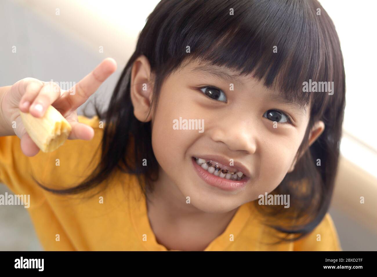 Petite fille asiatique montrant sa bouche ouverte pleine de caries dents de carie carie carie. Médecine dentaire et soins de santé. Caries à partir d'un âge précoce en raison de trop de CA sucré Banque D'Images