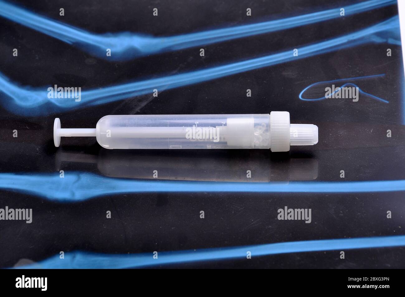 Seringue pour échantillons de sérum. L'intérieur est une substance qui empêche la coagulation du sang. Banque D'Images