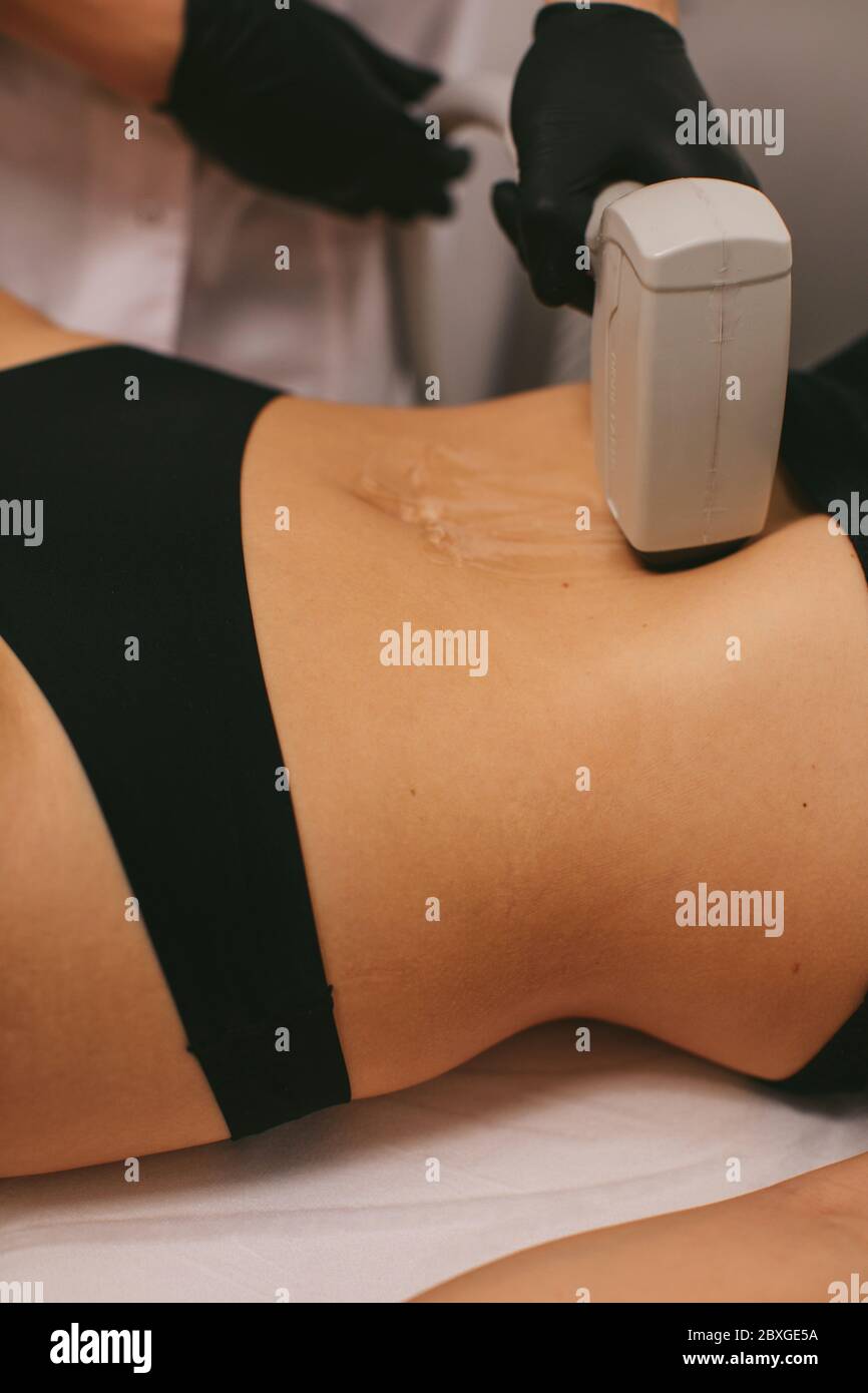 Femme ayant un traitement d'épilation au laser dans un salon de beauté Banque D'Images