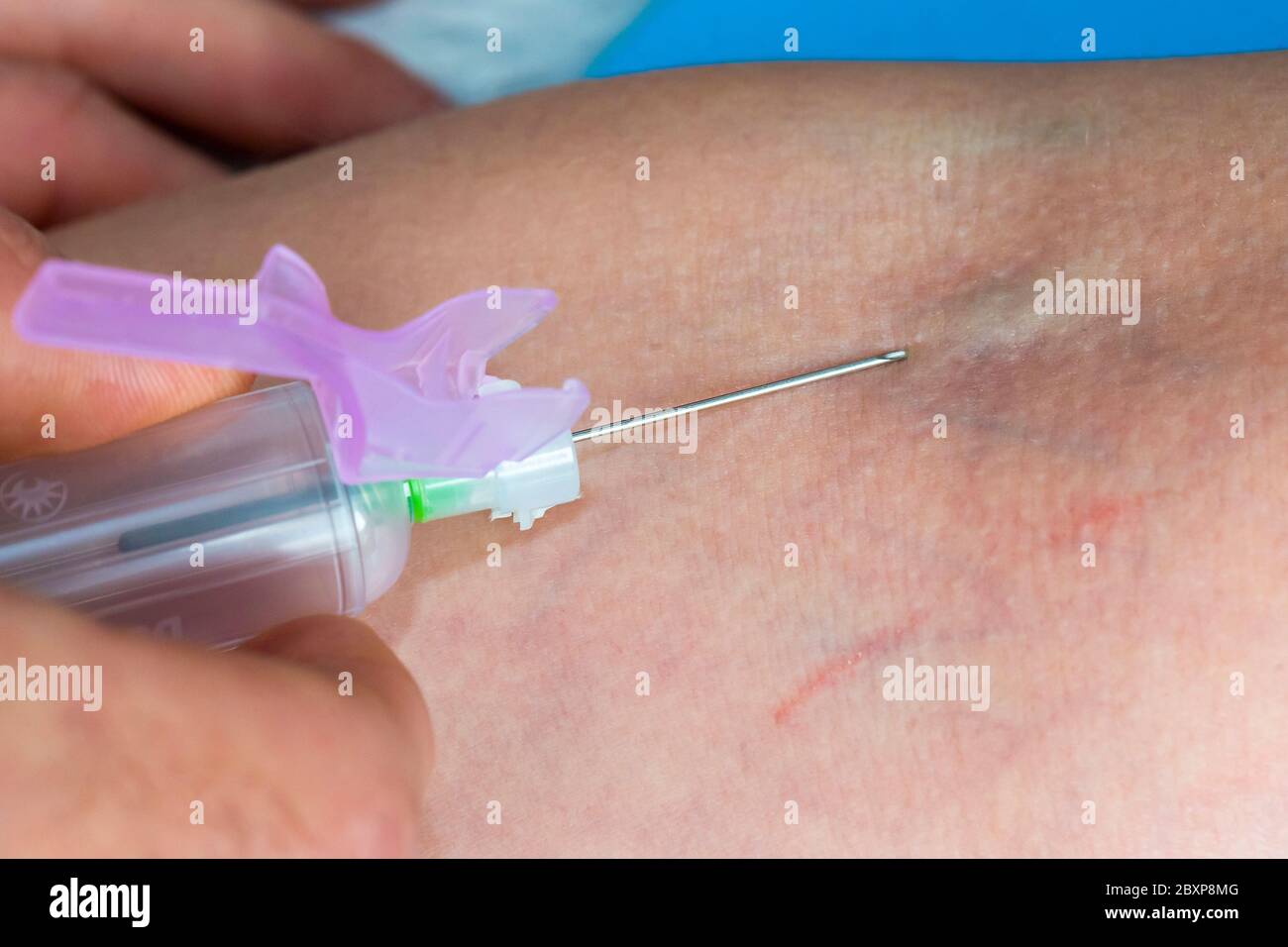 Un médecin prélève un échantillon de sang dans le bras d'un patient Banque D'Images