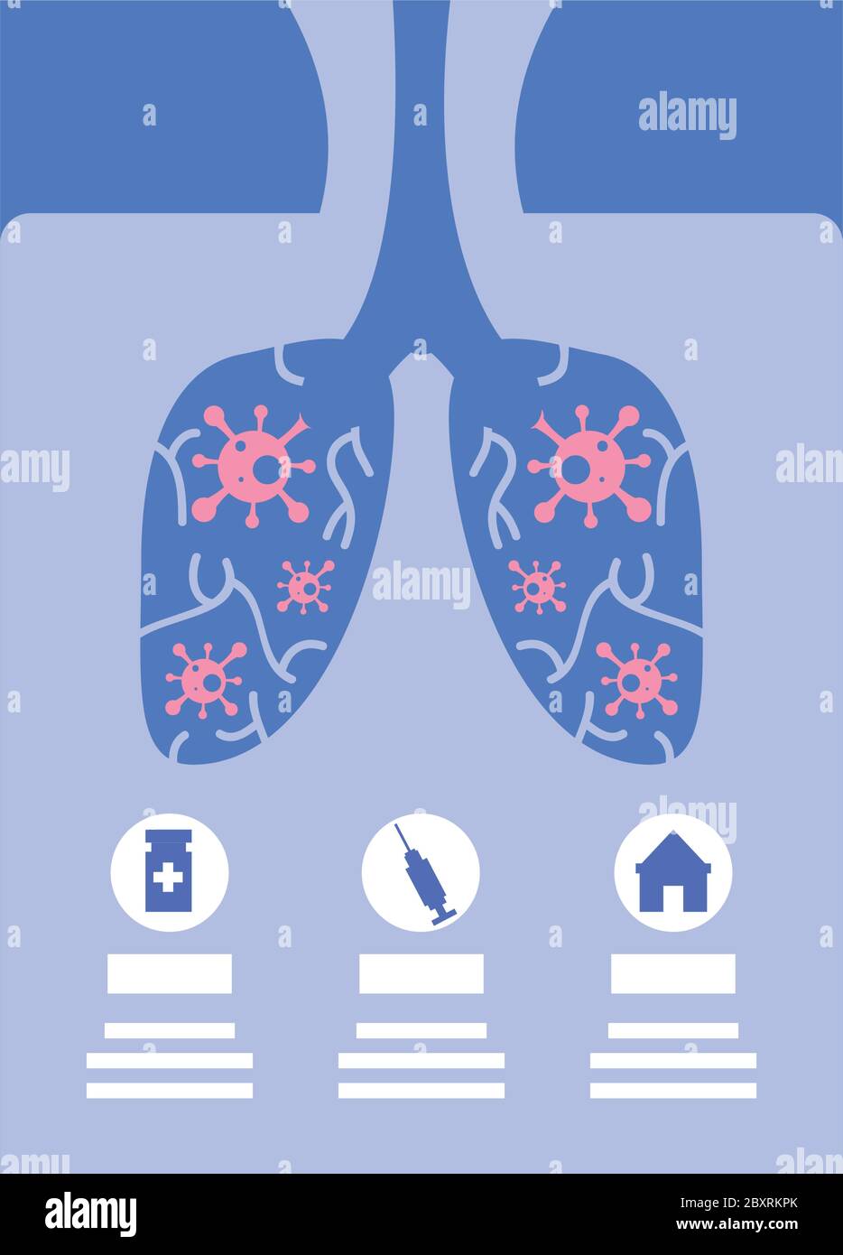 poumons humains touchés par le coronavirus, infographie coronavirus vecteur illustration design Illustration de Vecteur