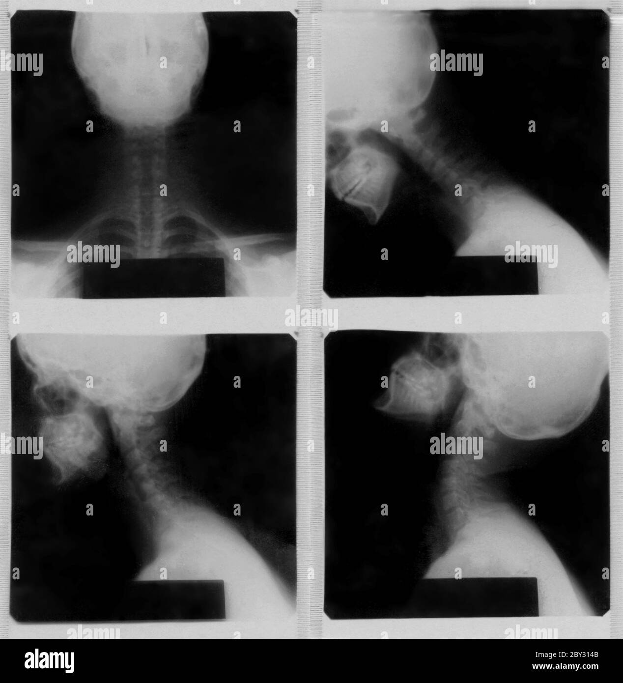 Colonne cervicale Banque D'Images