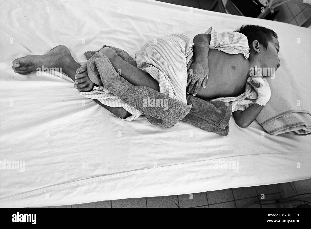 Hôpital d'urgence, Battambang, Cambodge, Asie, effets des mines terrestres Banque D'Images