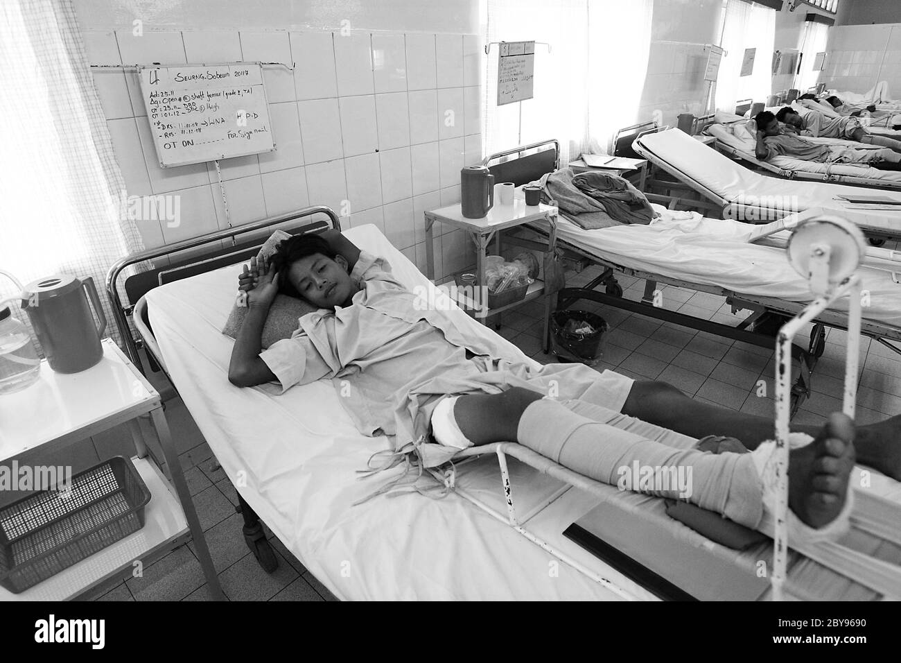 Hôpital d'urgence, Battambang, Cambodge, Asie, effets des mines terrestres Banque D'Images