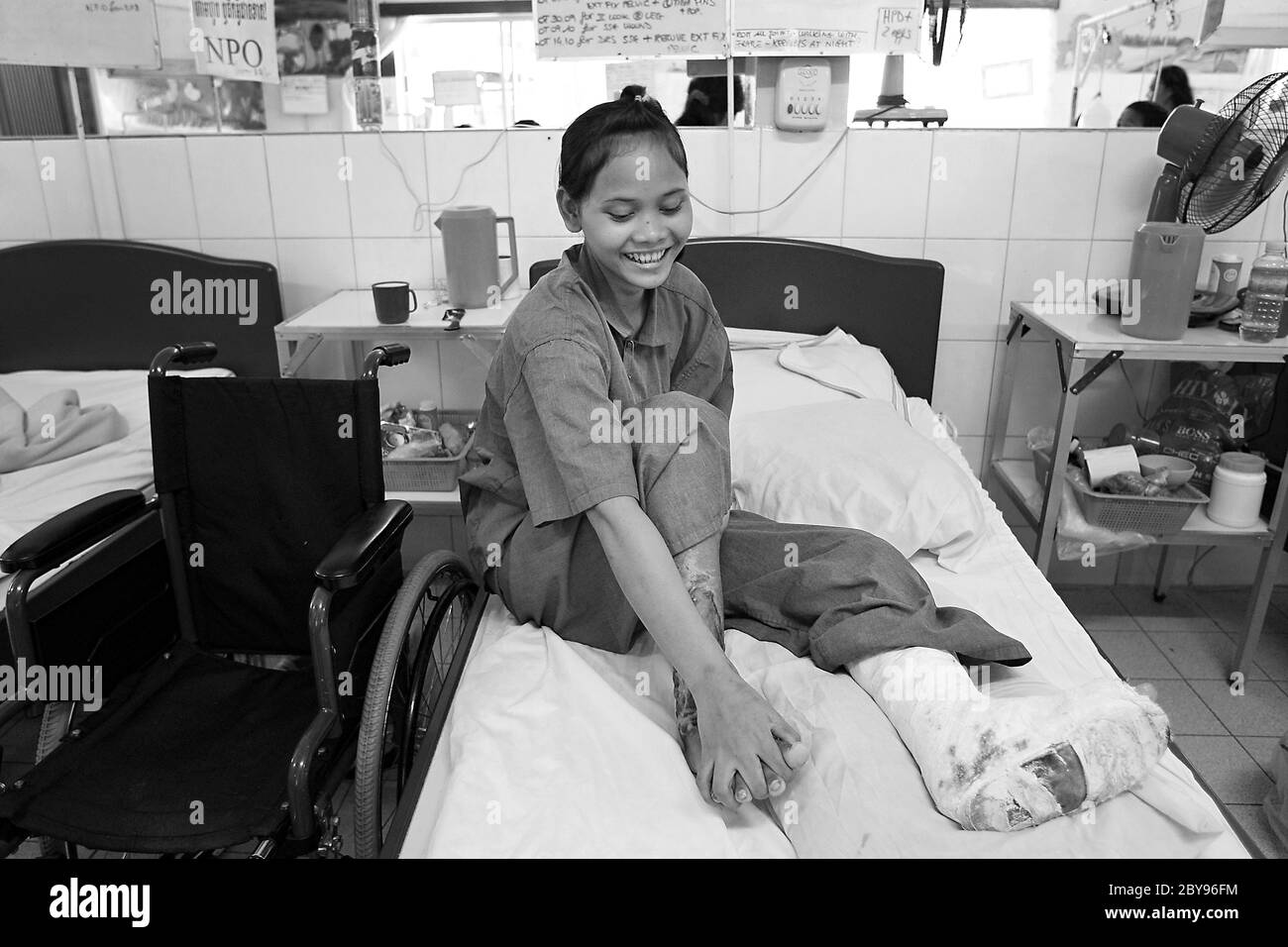 Hôpital d'urgence, Battambang, Cambodge, Asie, effets des mines terrestres Banque D'Images