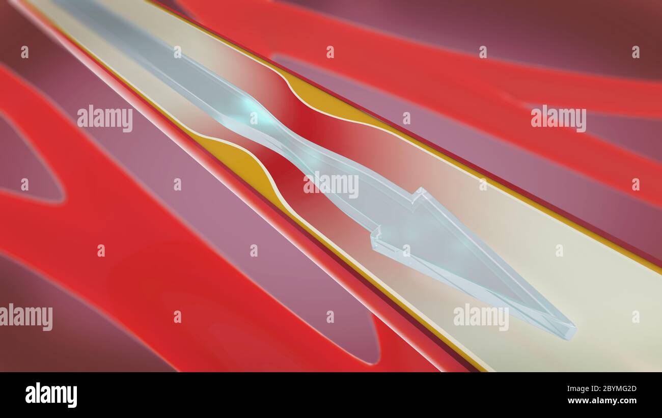 Illustration 3d d'une artère rétrécie et constriction des vaisseaux sanguins ou de l'artériosclérose appelée Banque D'Images