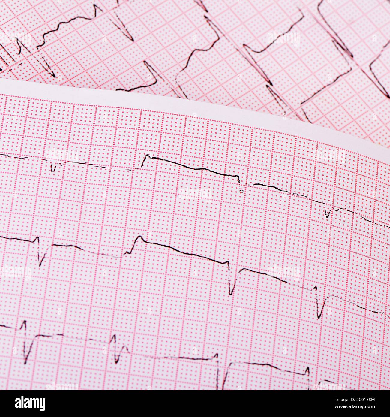 La bande avec le cardiogramme d'un homme Banque D'Images