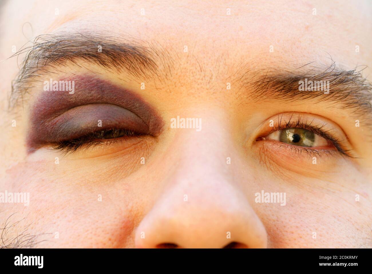 Œil noir. Banque D'Images