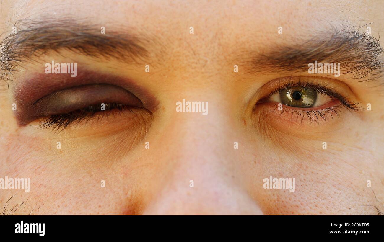 Œil noir. Banque D'Images