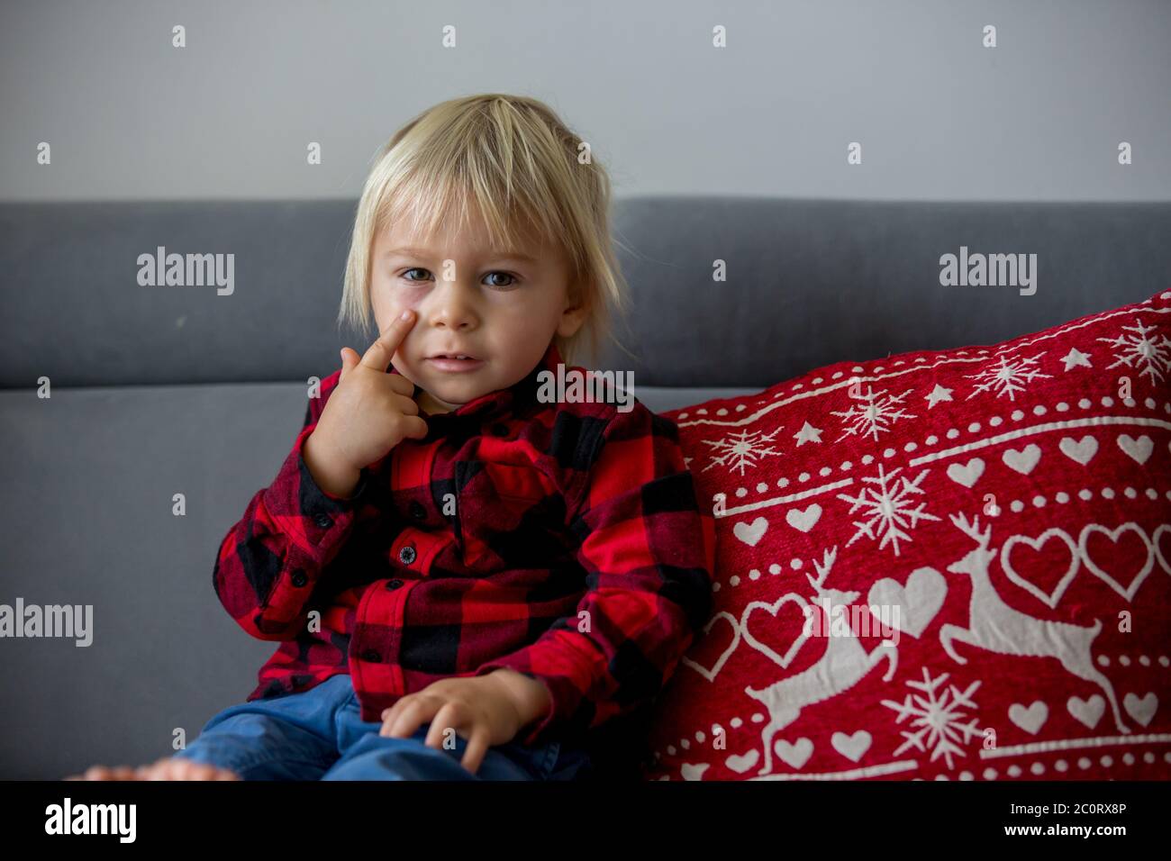 Un Jeune Garcon Blond Avec Un Point Rouge Brule Sous Les Yeux Sensation De Douleur Enfant Triste Photo Stock Alamy