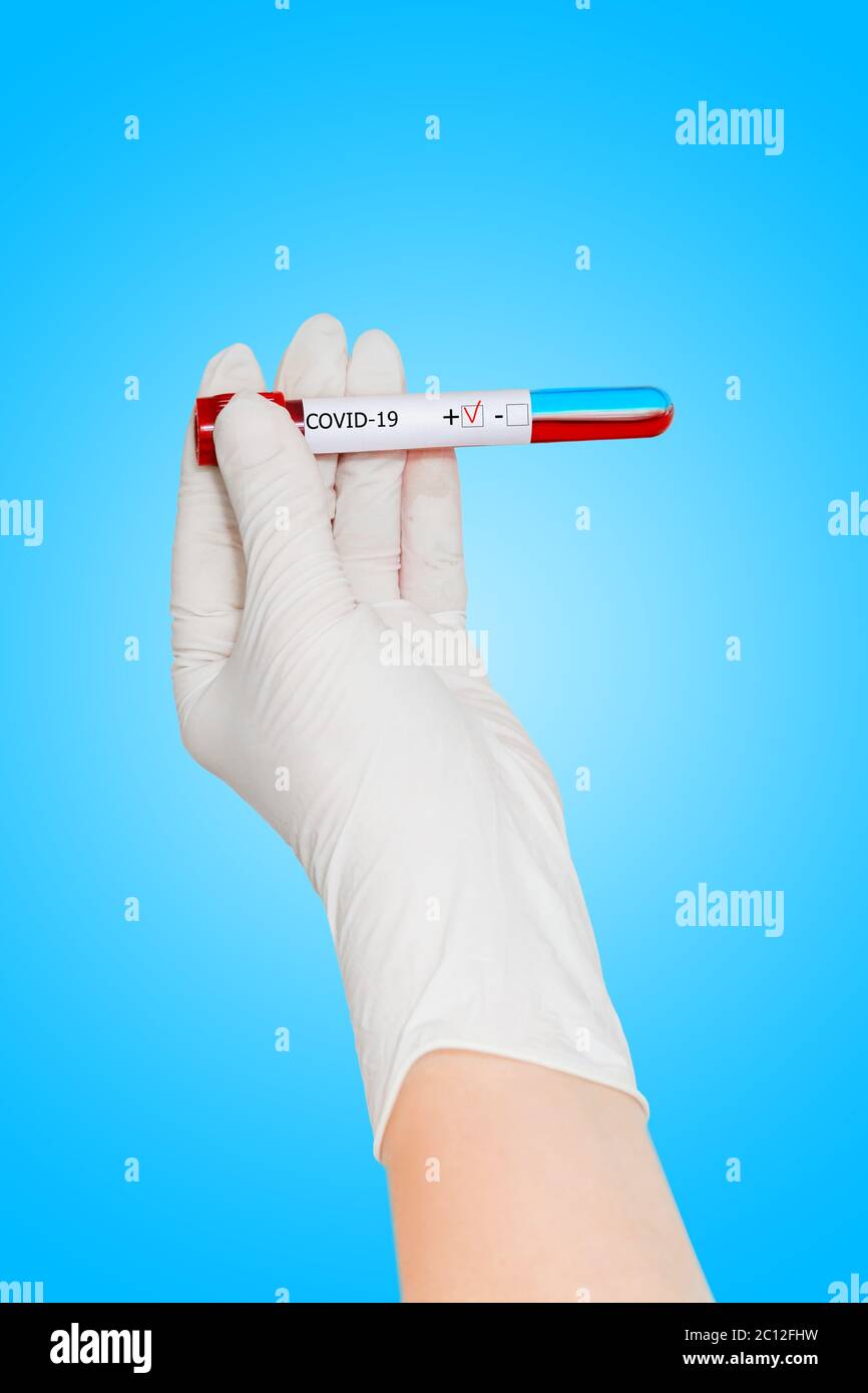 Main dans le gant médiaclal tient le tube à essai de sang avec étiquette positive, tube à essai avec le sang pour l'analyse de 2019 nCOV. Analyse en laboratoire du sang du patient. Banque D'Images