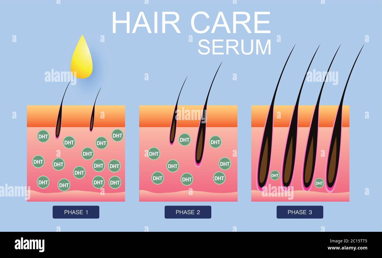 Sérum de soins capillaires, transplantation de cheveux, conception vectorielle Illustration de Vecteur