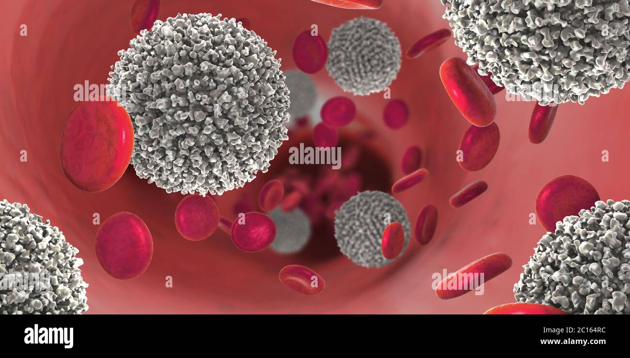 3d illustration de la forte augmentation de la non-fonctionnelles des globules blancs appelés cellules leucémiques conduisant à la maladie du cancer du sang Banque D'Images