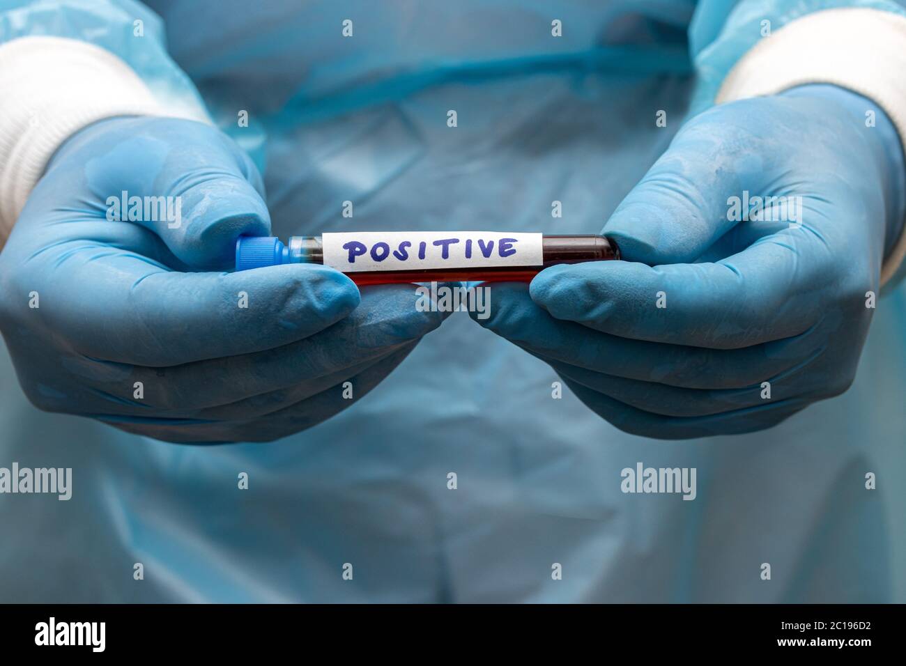 Un médecin présente un tube à essai avec des résultats positifs. Main gantée tenant un tube à essai avec du sang. Une recherche en laboratoire du sang. Banque D'Images