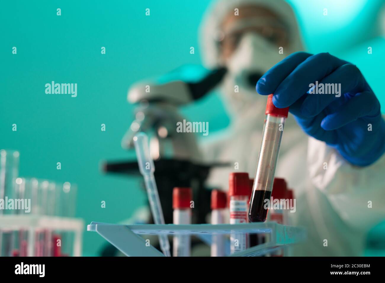 Gros plan d'un expert de laboratoire méconnaissable en gants pour vérifier la présence d'anticorps du coronavirus en laboratoire Banque D'Images