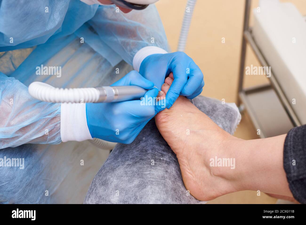 Traitement des maladies fongiques de la peau des pieds et des ongles. Banque D'Images