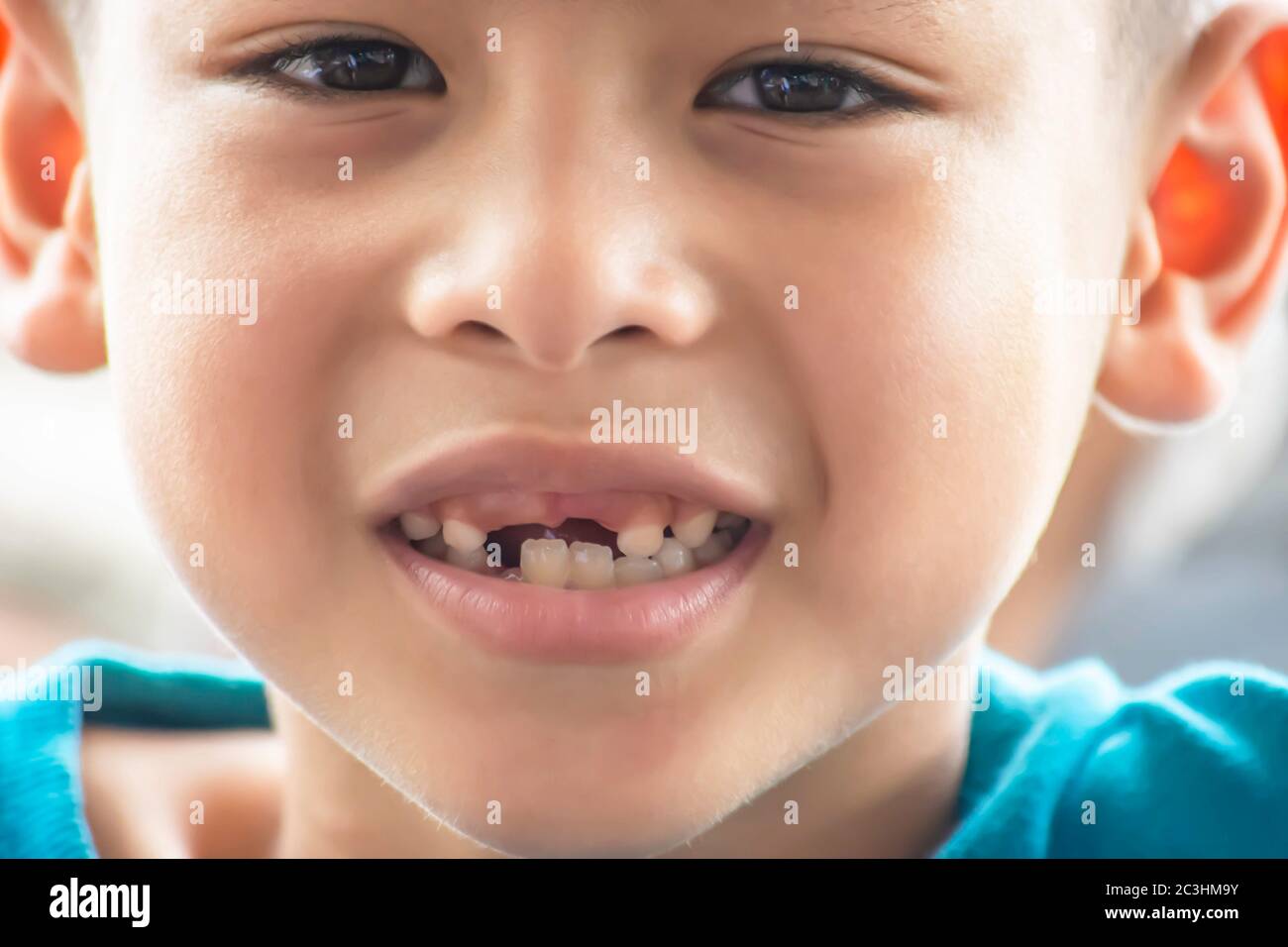 Les Dents De Bebe Sont Juste Tombe Dans La Bouche Photo Stock Alamy