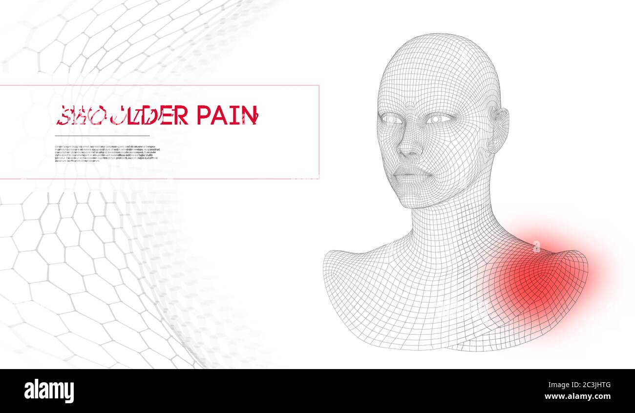 Femme avec douleur d'épaule. Tête filaire 3d. Illustration vectorielle. Illustration de Vecteur