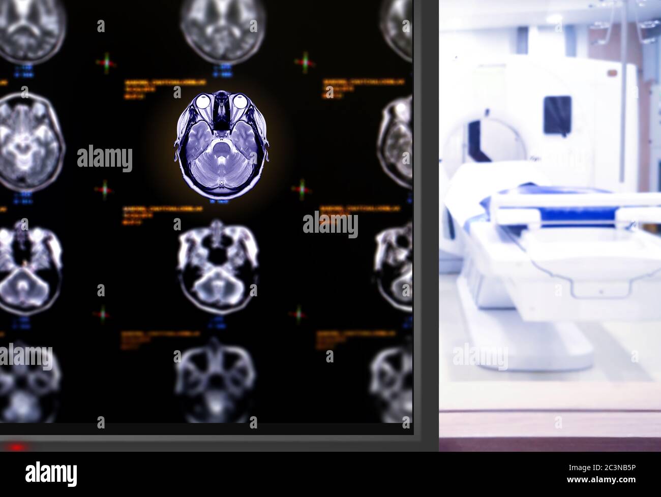 IRM Plan axial du cerveau sur le mornitor dans la salle d'IRM de l'hôpital. Banque D'Images
