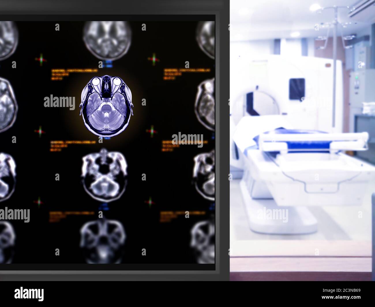 IRM Plan axial du cerveau sur le mornitor dans la salle d'IRM de l'hôpital. Banque D'Images