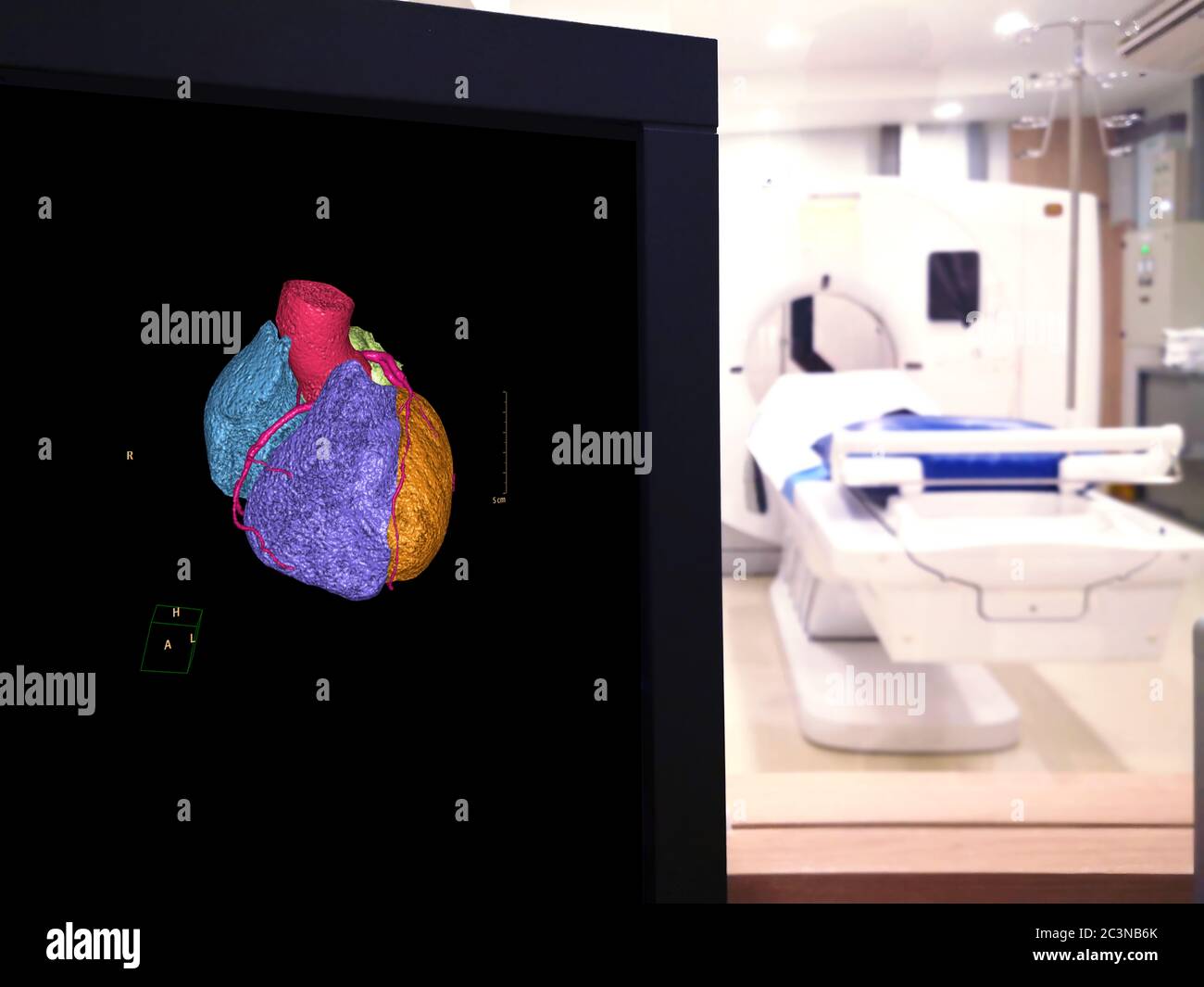 Image de rendu 3D de l'artère coronaire CTA sur le mornitor dans la salle d'examen CT de l'hôpital. Banque D'Images