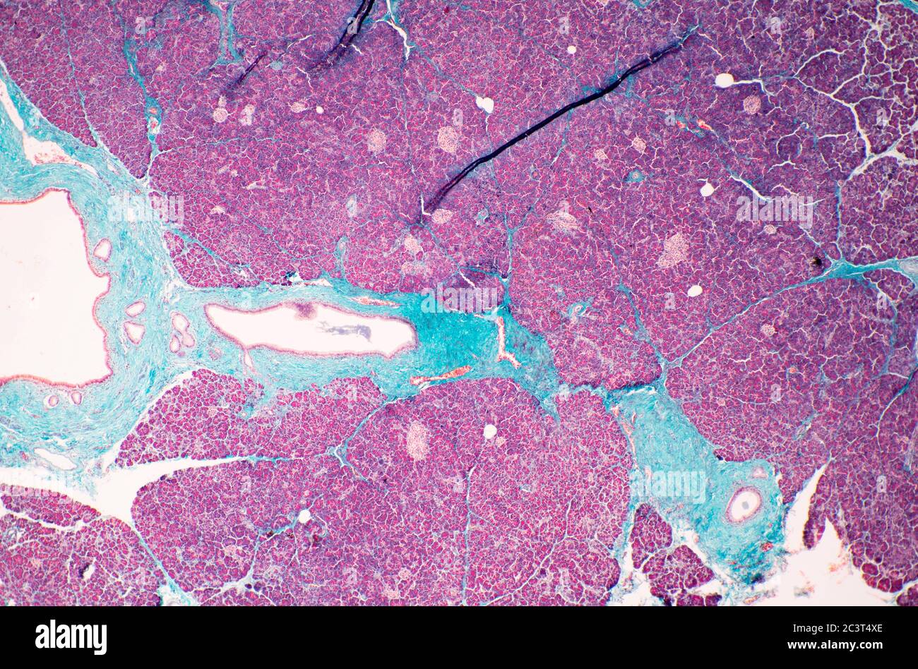 Pancréas, section mince colorée, vue au microscope Banque D'Images