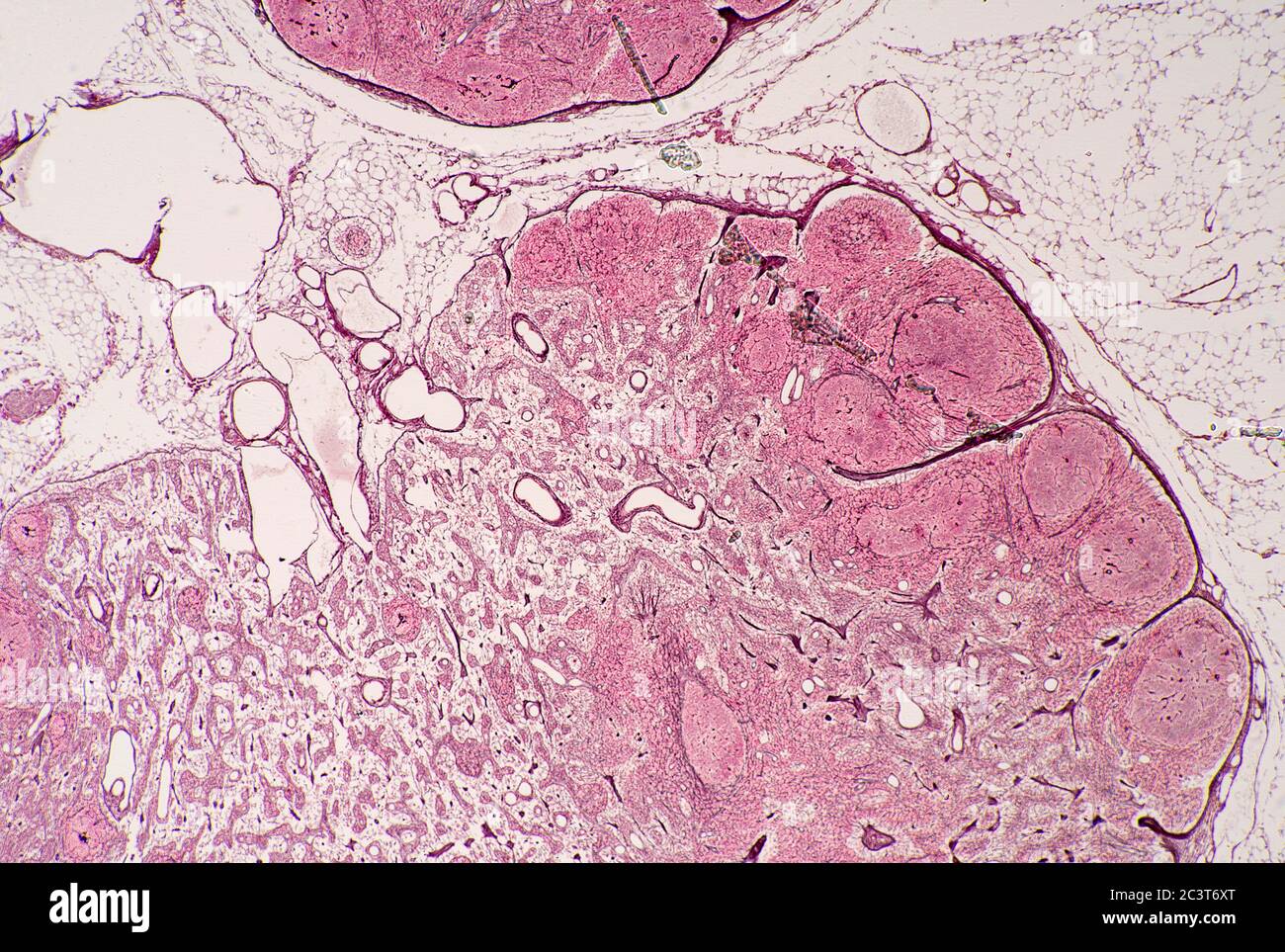 Images détaillées de ganglion lymphatique, vue au microscope Banque D'Images