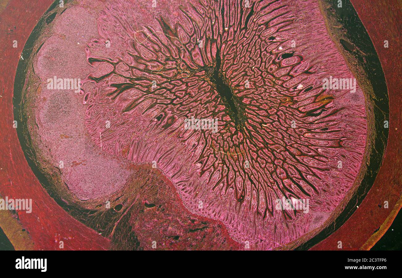 Iléum mammifère, Peyers Patch, vue au microscope Banque D'Images