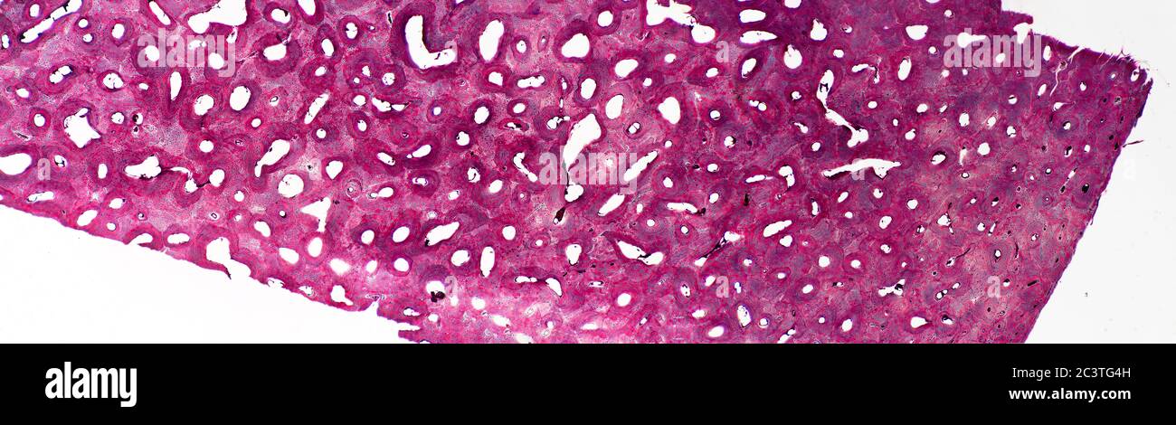 Section osseuse de mammifère, vue au microscope Banque D'Images