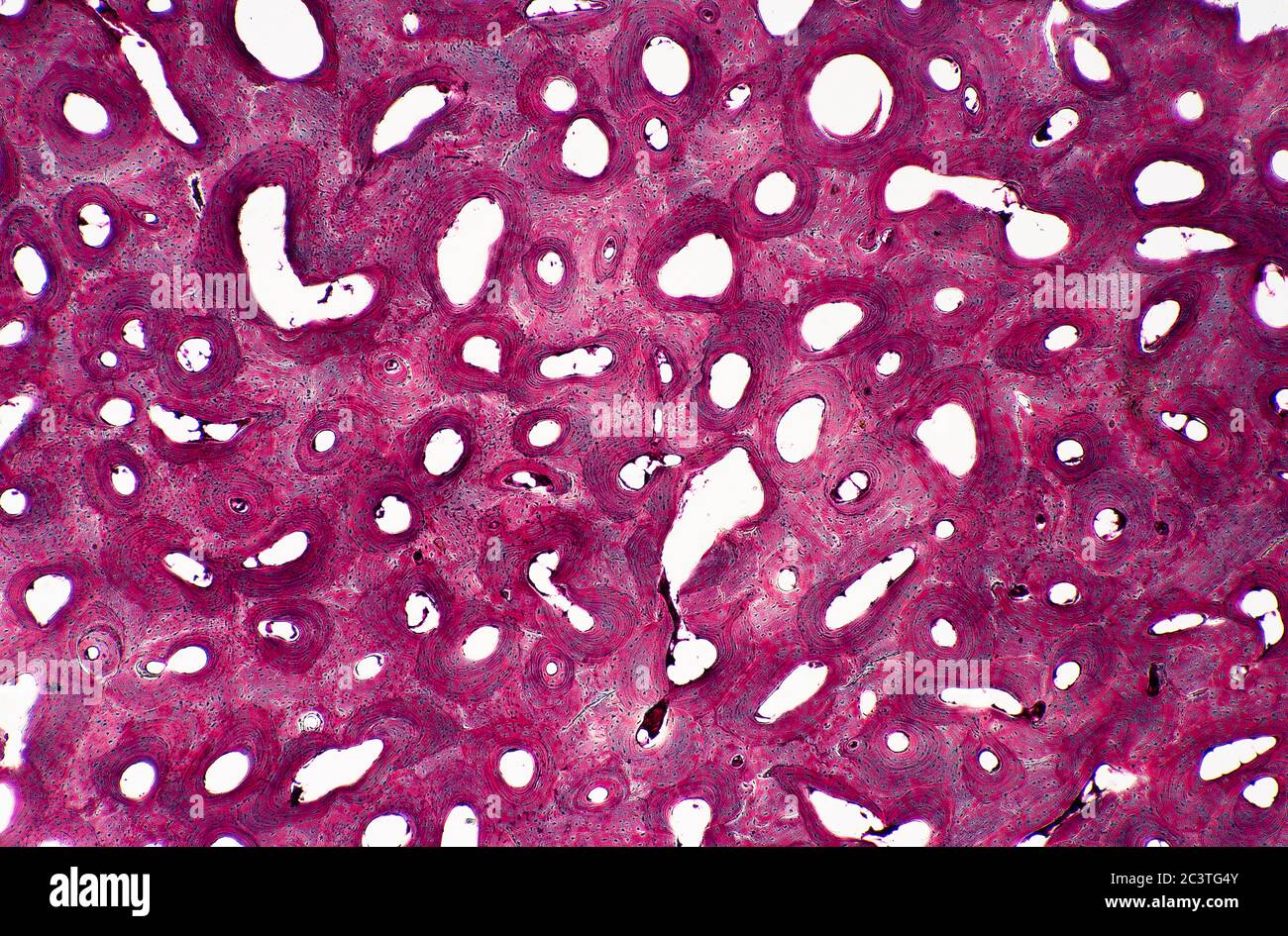 Section osseuse de mammifère, vue au microscope. Banque D'Images