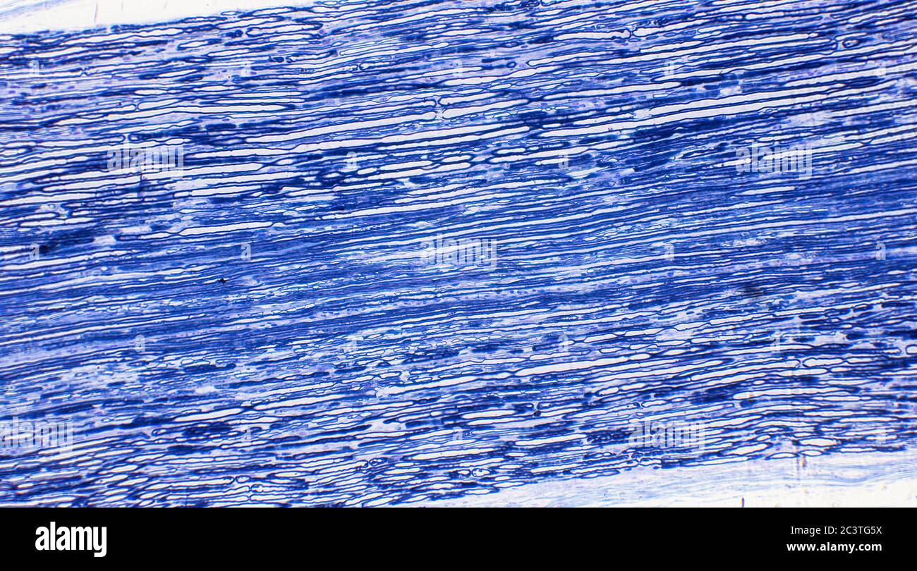 Nerf sciatique mammifère, coupe transversale longitudinale, vue au microscope Banque D'Images