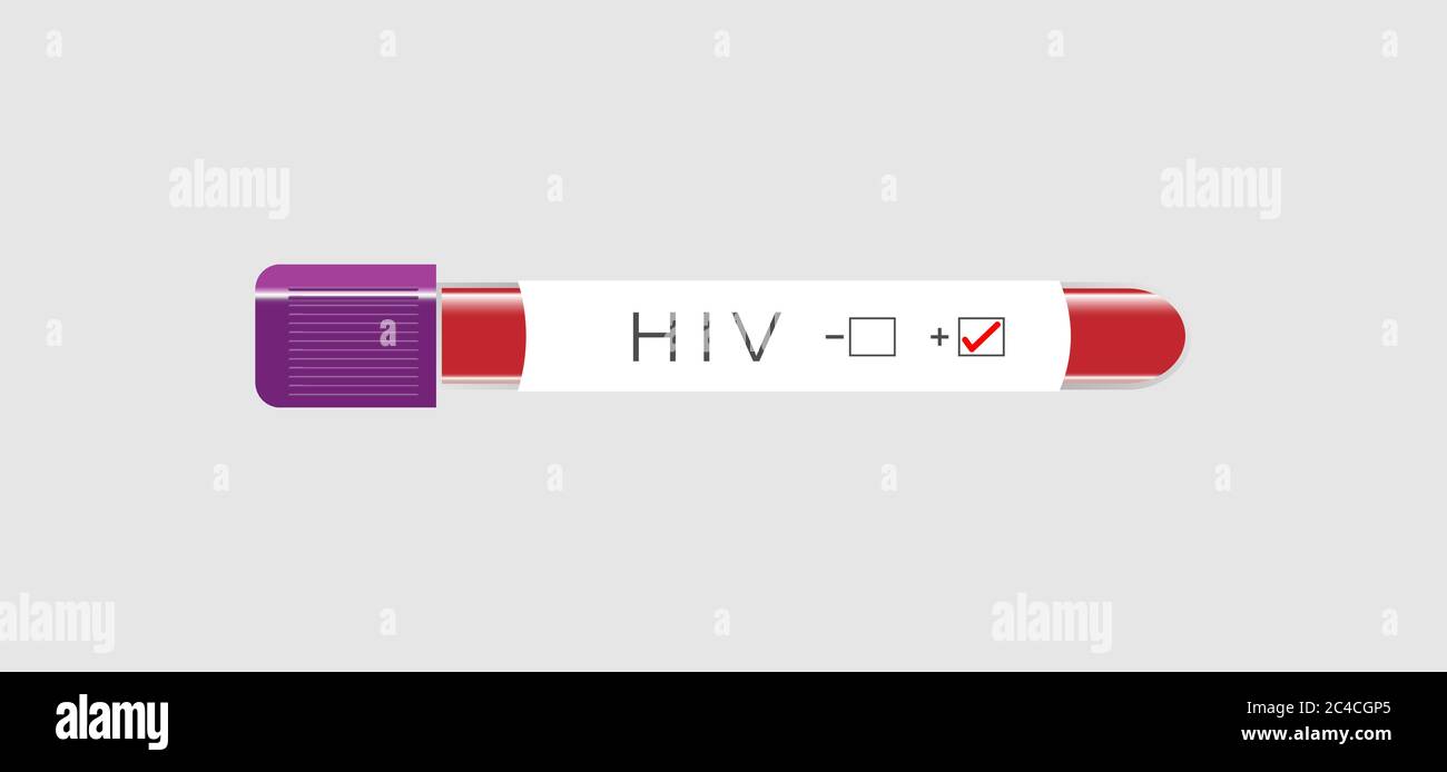 Tube de prélèvement sanguin avec étiquette de test VIH sur l'illustration du vecteur d'infection à VIH Illustration de Vecteur