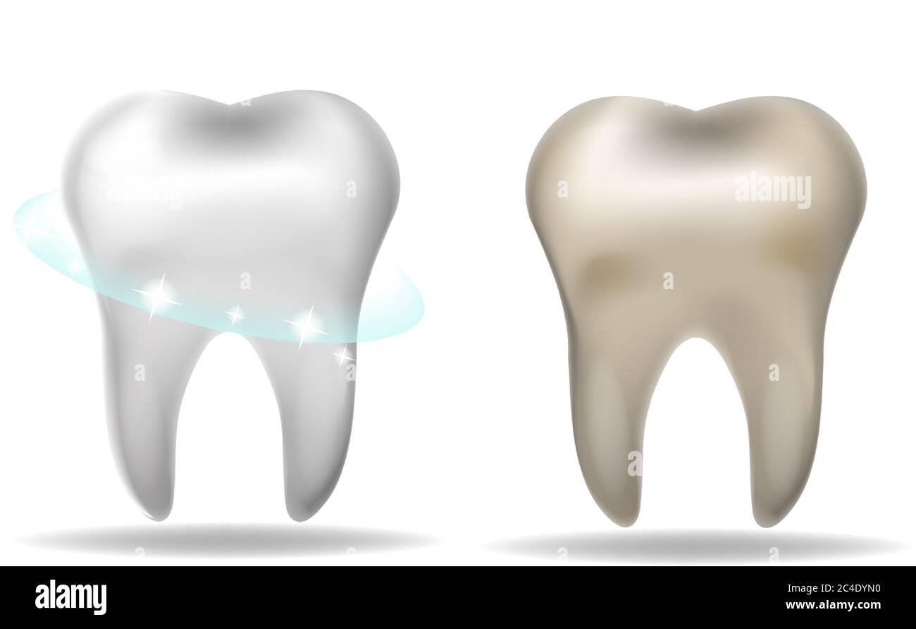Concept de blanchiment des dents. Blanc dent et jaune sale style 3d réaliste. Illustration vectorielle Illustration de Vecteur