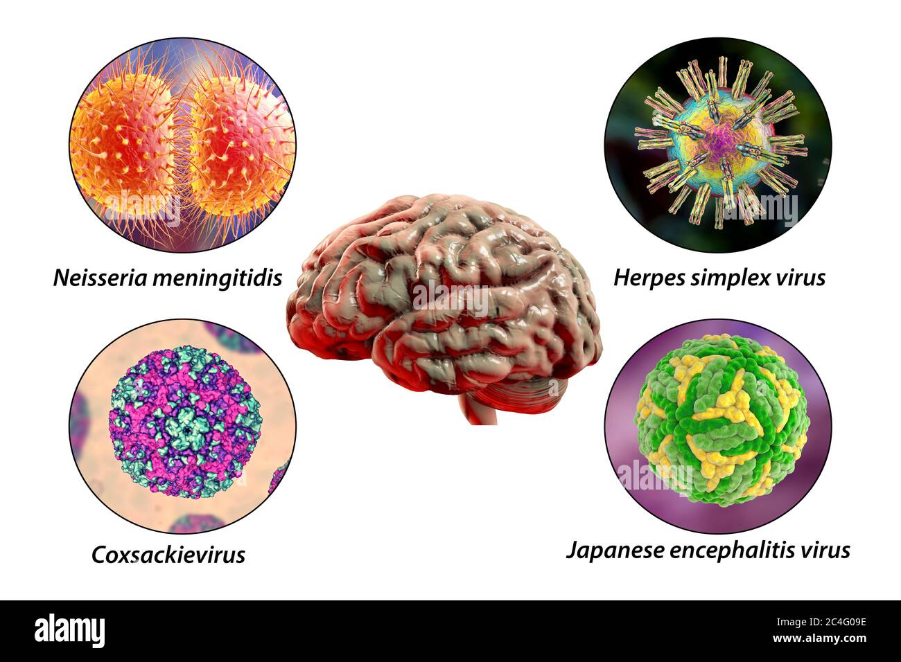 Infections cérébrales. Illustration informatique des micro-organismes ...