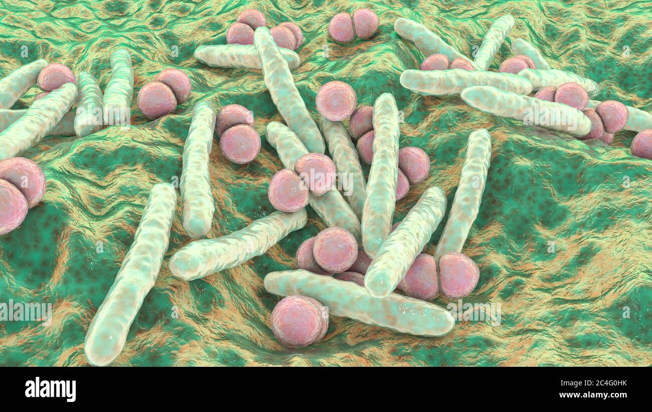 Illustration informatique de la co-infection avec deux bactéries pathogènes respiratoires majeures, Mycobacterium tuberculosis (en forme de tige) et Streptococcus pneumonia (sphérique). Les infections pulmonaires mixtes avec deux agents pathogènes ou plus sont courantes chez les patients immunodéprimés, en particulier chez les personnes infectées par le VIH. Banque D'Images