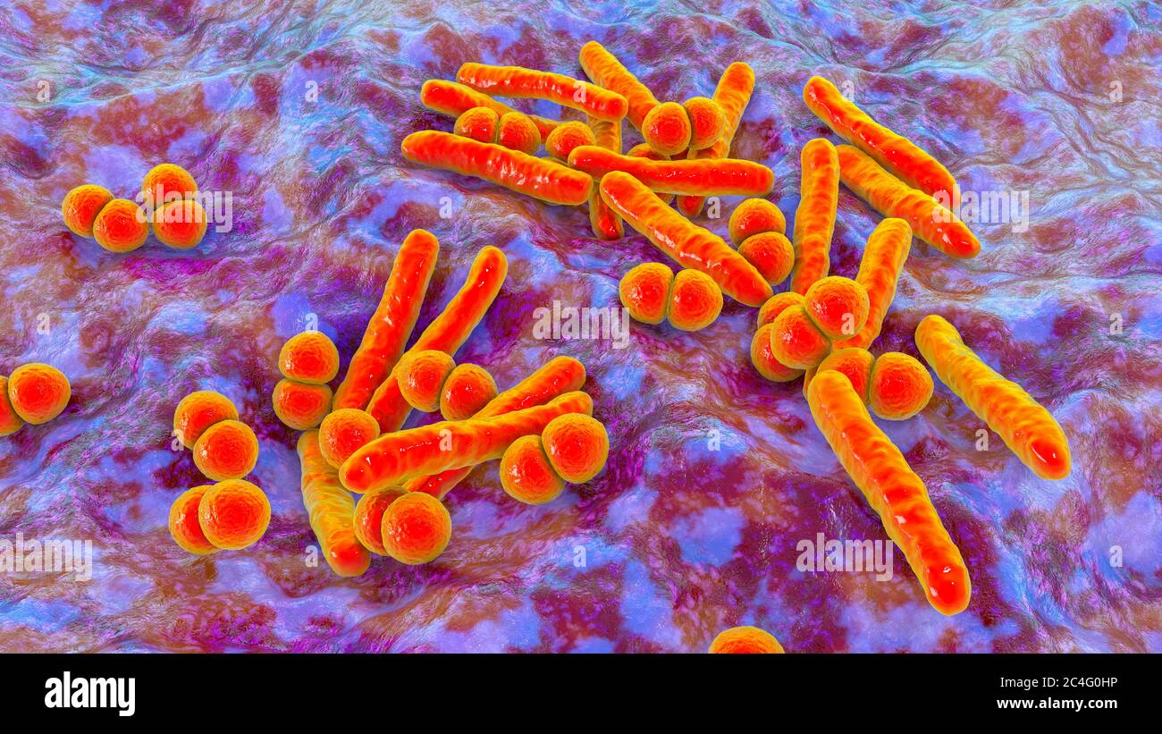 Illustration informatique de la co-infection avec deux bactéries pathogènes respiratoires majeures, Mycobacterium tuberculosis (en forme de tige) et Streptococcus pneumonia (sphérique). Les infections pulmonaires mixtes avec deux agents pathogènes ou plus sont courantes chez les patients immunodéprimés, en particulier chez les personnes infectées par le VIH. Banque D'Images