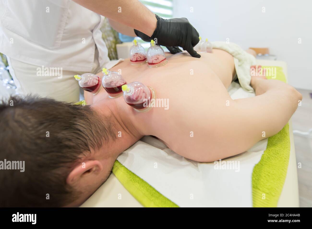 Jeune homme se reposant à la table de massage et faisant un traitement de hijama Banque D'Images