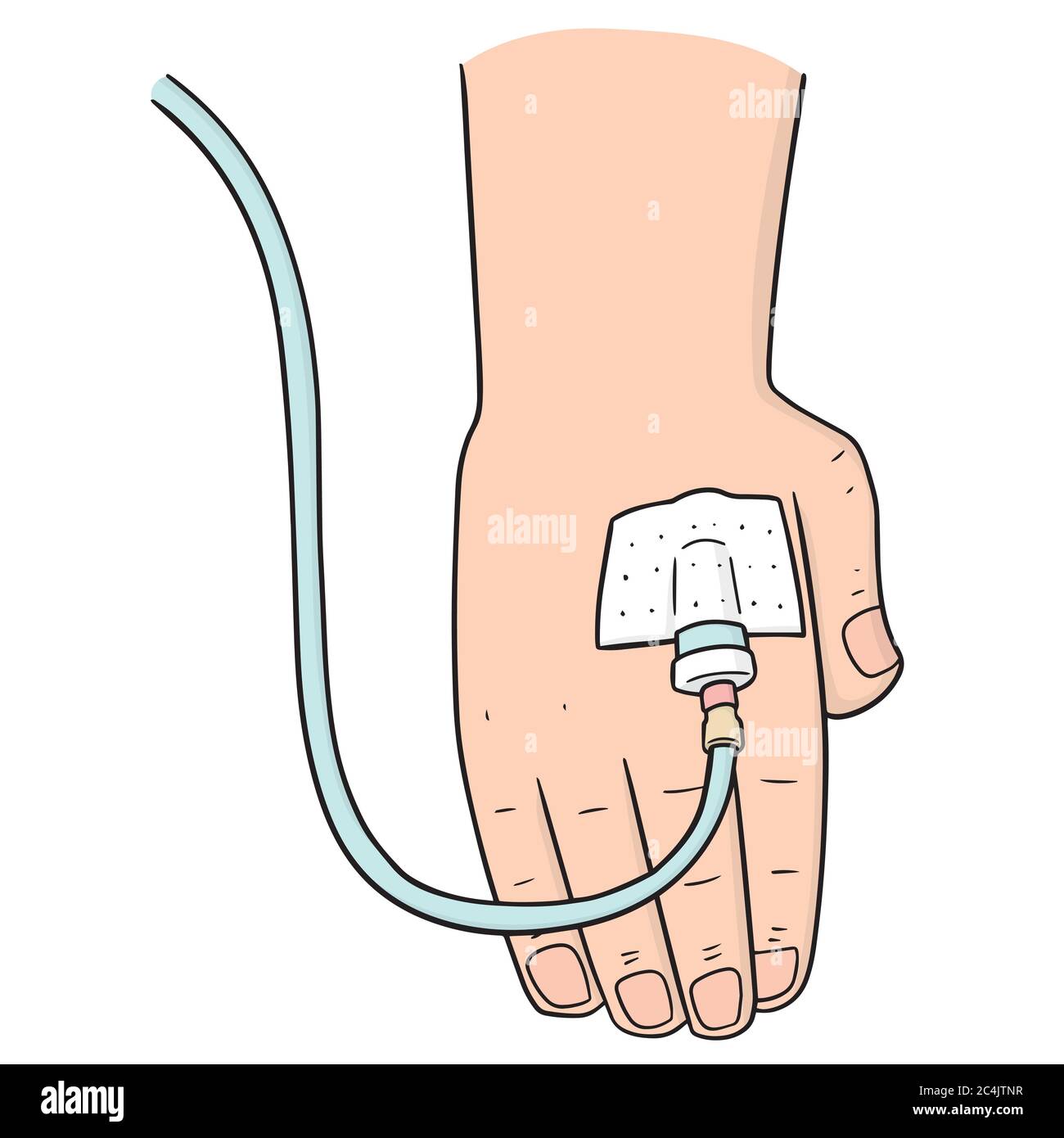 kit vectoriel de perfusion intraveineuse Illustration de Vecteur