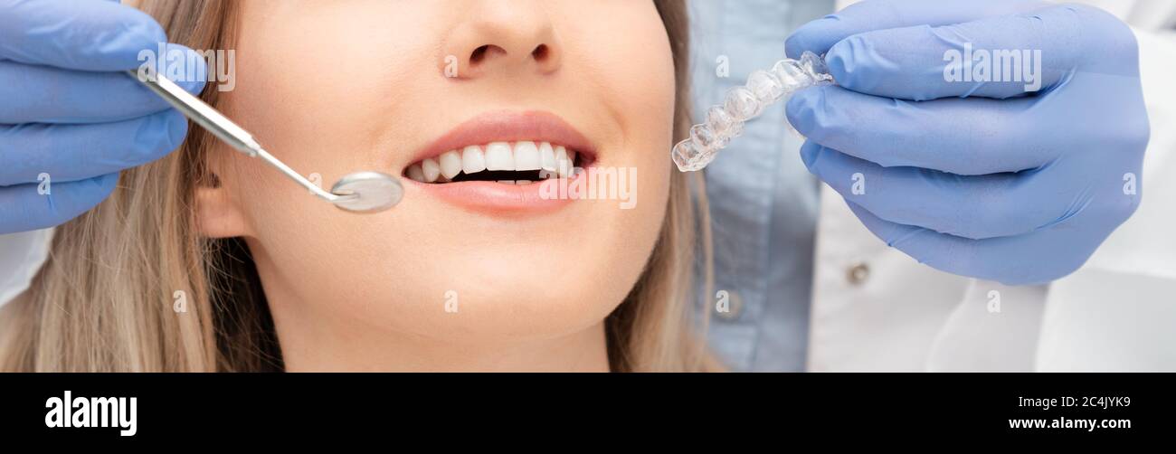 Femme ayant des dents examinées chez les dentistes. Blanchiment des dents, concept de soins dentaires Banque D'Images