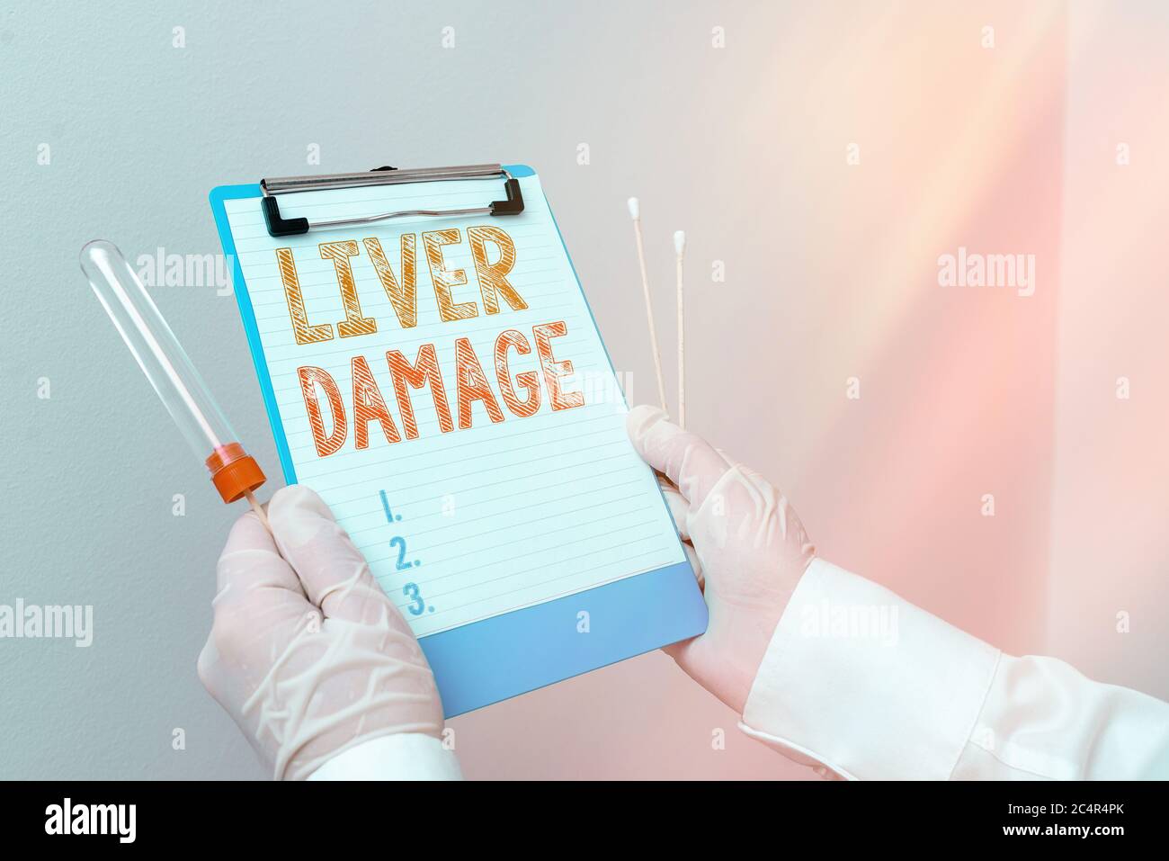 Signe textuel montrant des lésions hépatiques. Photo d'affaires présentant tout trouble de la cirrhose du foie ou de la cicatrisation du foie laboratoire échantillon de sang SH Banque D'Images